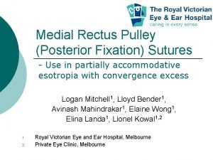 Medial Rectus Pulley Posterior Fixation Sutures Use in