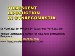 TUMESCENT LIPOSUCTION IN GYNAECOMASTIA Dr Venkataram MysoreDr Jayashree