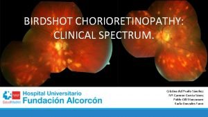 Birdshot chorioretinopathy treatment