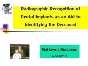 Radiographic Recognition of Dental Implants as an Aid