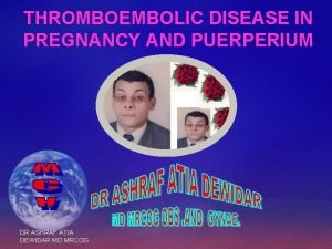 THROMBOEMBOLIC DISEASE IN PREGNANCY AND PUERPERIUM DR ASHRAF