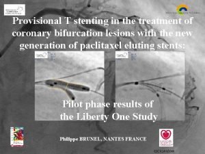 Inverted provisional stenting