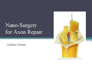Axon