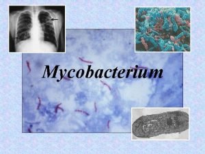 Mycobacterium kvtkovit kolonie MDRTB and XDRTB strain Mycobacterium