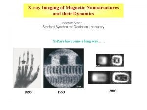 X ray imaging