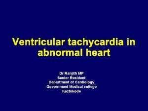 Ventricular tachycardia in abnormal heart Dr Ranjith MP