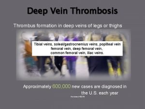 Deep Vein Thrombosis Thrombus formation in deep veins