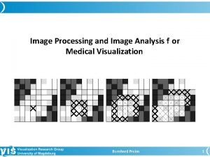 Image Processing and Image Analysis f or Medical