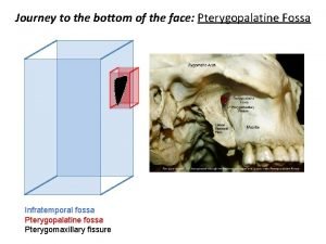 Pterygomaxillary fascia