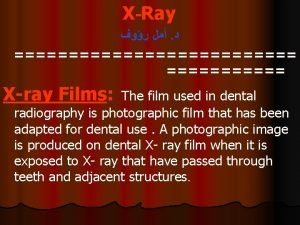 The purpose of a lead foil sheet in the film packet is The purpose of a lead foil sheet in the film packet is