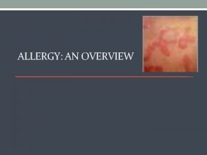 ALLERGY AN OVERVIEW Contents q Allergy q Hypersensitivity