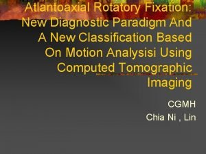 Atlantoaxial Rotatory Fixation New Diagnostic Paradigm And A