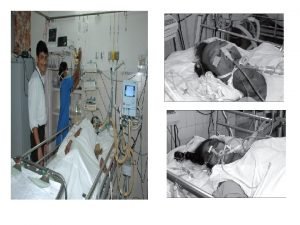 Pressure support ventilation ppt Pressure support ventilation ppt