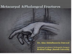 Metacarpal Phalangeal Fractures Dr Alaa Abdulhussein Dawood Assistant