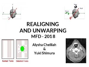 REALIGNING AND UNWARPING MFD 201 8 Alysha Chelliah