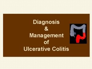 Diagnosis Management of Ulcerative Colitis Epidemiology Ulcerative colitis
