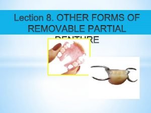 GUIDEPLANE RPD SWINGLOCK RPD REMOVABLE PARTIAL OVERDENTURE IMPLANT