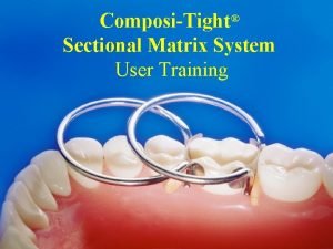 ComposiTight Sectional Matrix System User Training ComposiTight solves