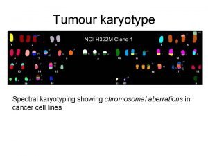 Tumour karyotype Spectral karyotyping showing chromosomal aberrations in