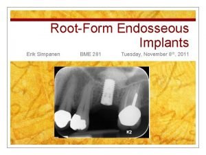 RootForm Endosseous Implants Erik Simpanen BME 281 Tuesday