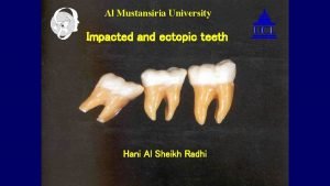 Al Mustansiria University Impacted and ectopic teeth Hani