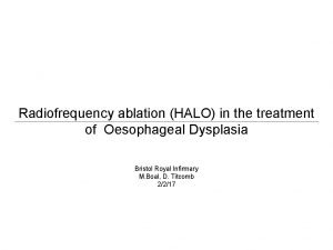 Radiofrequency ablation HALO in the treatment of Oesophageal