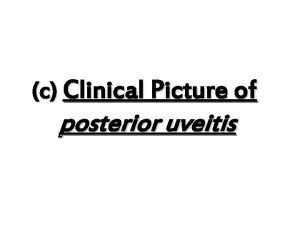 c Clinical Picture of posterior uveitis Clinical Features