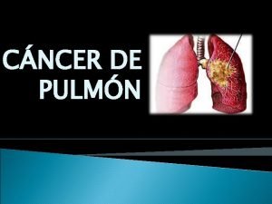 Tnm cáncer de pulmón 2021 Tnm cáncer de pulmón 2021