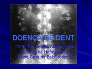 DOENA DE DENT Dr Milton Soares Campos Neto