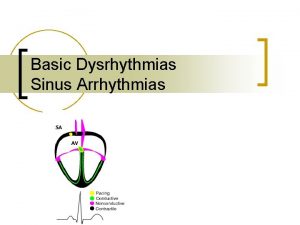 Basic Dysrhythmias Sinus Arrhythmias Basic Rhythm Strip Interpretation