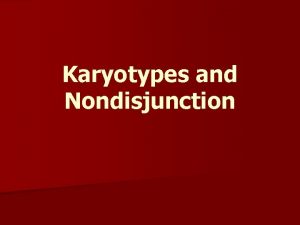 Nondisjunction karyotype