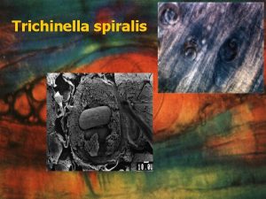 Trichinella spiralis Triquinosis n n Infeccin parasitaria endmica