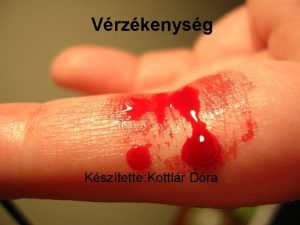 Vrzkenysg Ksztette Kottlr Dra Vrzkenysg vagy msnven hemoflia