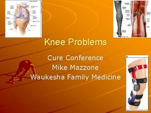 Knee Problems Cure Conference Mike Mazzone Waukesha Family