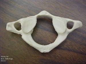 Atlas cervical vertebrae