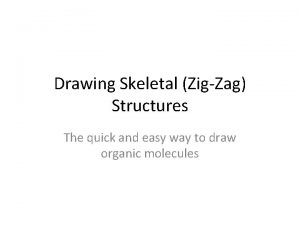 Zigzag rule drawing