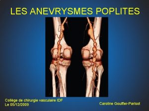 Poplites Poplites