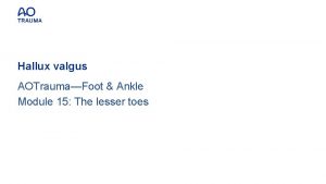 Hallux valgus AOTraumaFoot Ankle Module 15 The lesser