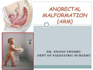 ANORECTAL MALFORMATION ARM DR ENONO YHOSHU DEPT OF
