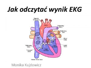 Jak odczyta wynik EKG Monika Kujdowicz Odprowadzenia V