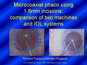 Microcoaxial phaco using 1 8 mm incisions comparison