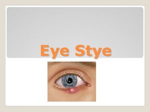 Worst stye ever Worst stye ever