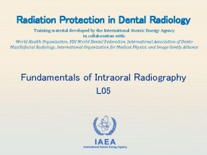 Faulty radiographs