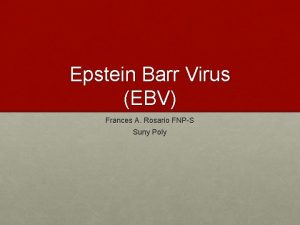 Epstein Barr Virus EBV Frances A Rosario FNPS
