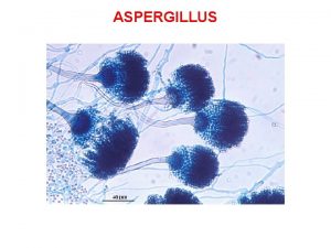 ASPERGILLUS CARATTERISTICHE MICROSCOPICHE DI Aspergillus Ife sottili settate
