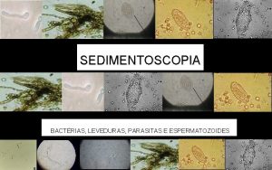 Sedimentoscopia leveduras