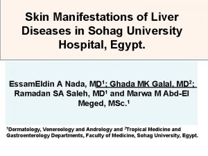 Skin Manifestations of Liver Diseases in Sohag University