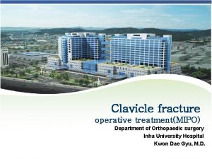 Clavicle fracture operative treatmentMIPO Department of Orthopaedic surgery