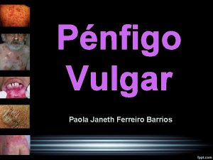 Pnfigo Vulgar Paola Janeth Ferreiro Barrios HISTORIA 1860