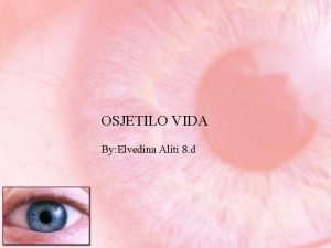 OSJETILO VIDA By Elvedina Aliti 8 d Oko